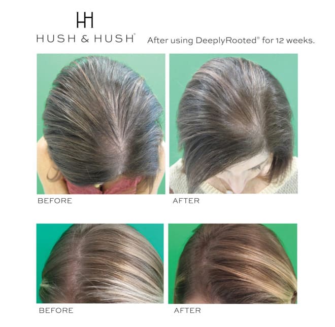 F5 mái tóc với 4 dưỡng chất “vàng” được chứng minh bởi khoa học trong y học tái tạo